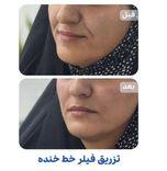 کلینیک زیبایی مهرآرا (شعبه پرند) - 9